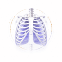 Chest X-Ray